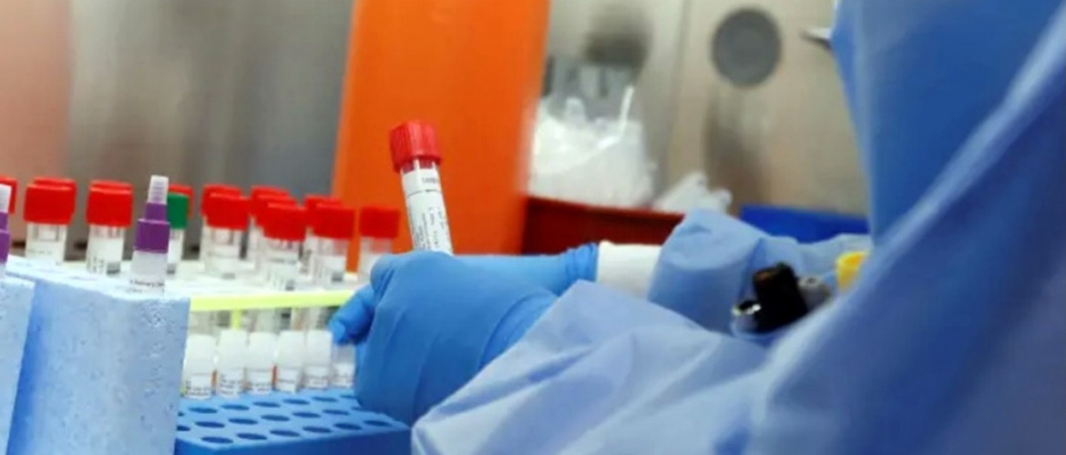 Izraeli áttörés: új, gyorsabb, olcsóbb koronavírus-tesztet fejlesztettek ki